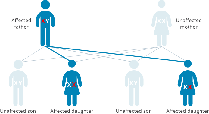 Fabry Disease Inheritance | From Fathers